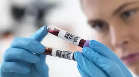 Des scientifiques chinois créent un test sanguin d'IA permettant de diagnostiquer des maladies 15 ans avant l'apparition des symptômes
