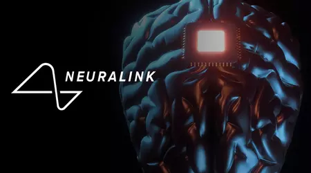 Une personne non verbale ouverte à la communication : Neuralink a réalisé la troisième opération réussie d'implantation d'une puce dans le cerveau d'un patient