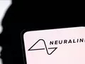 Первый пациент Neuralink может управлять компьютерной мышью с помощью мышления