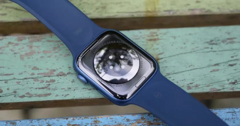 Стэнфордское исследование: Apple Watch и AI борются с CRPS у детей