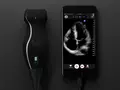 post_big/portable-ultrasound-butterfly-iq-1.jpg