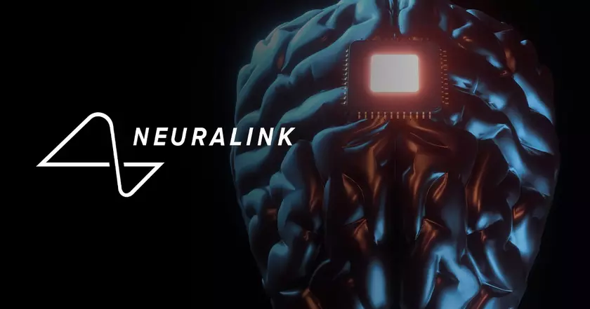 Мозговые чипы от Neuralink: новые горизонты или источник опасности?