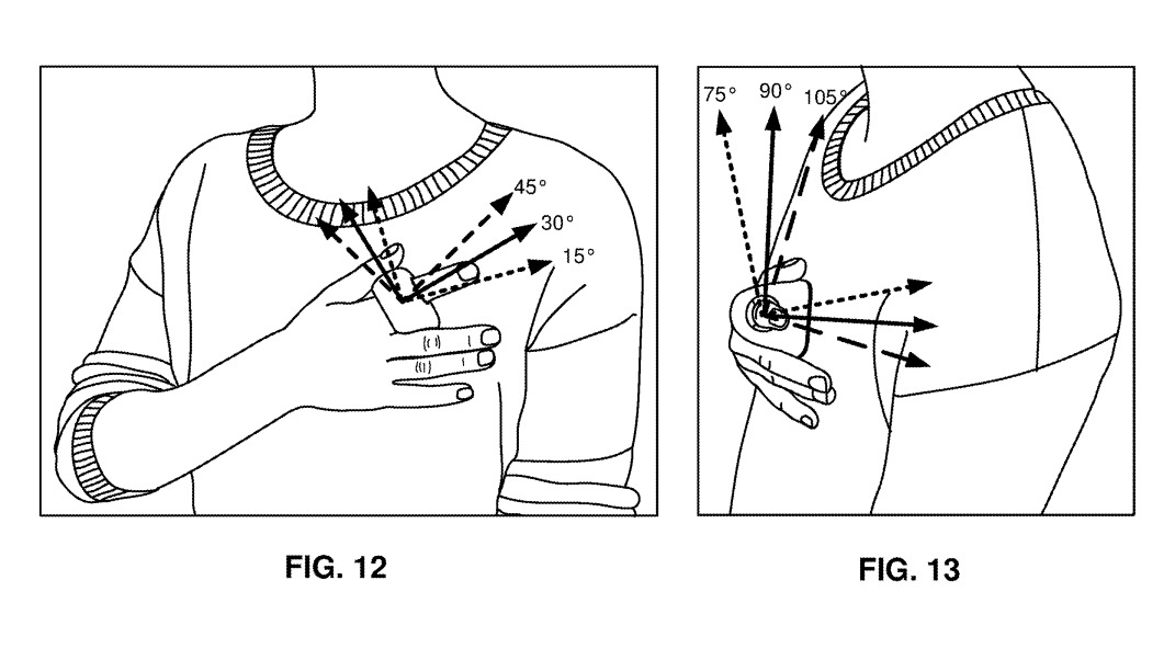Patent for a Fitbit device for measuring blood pressure on the finger