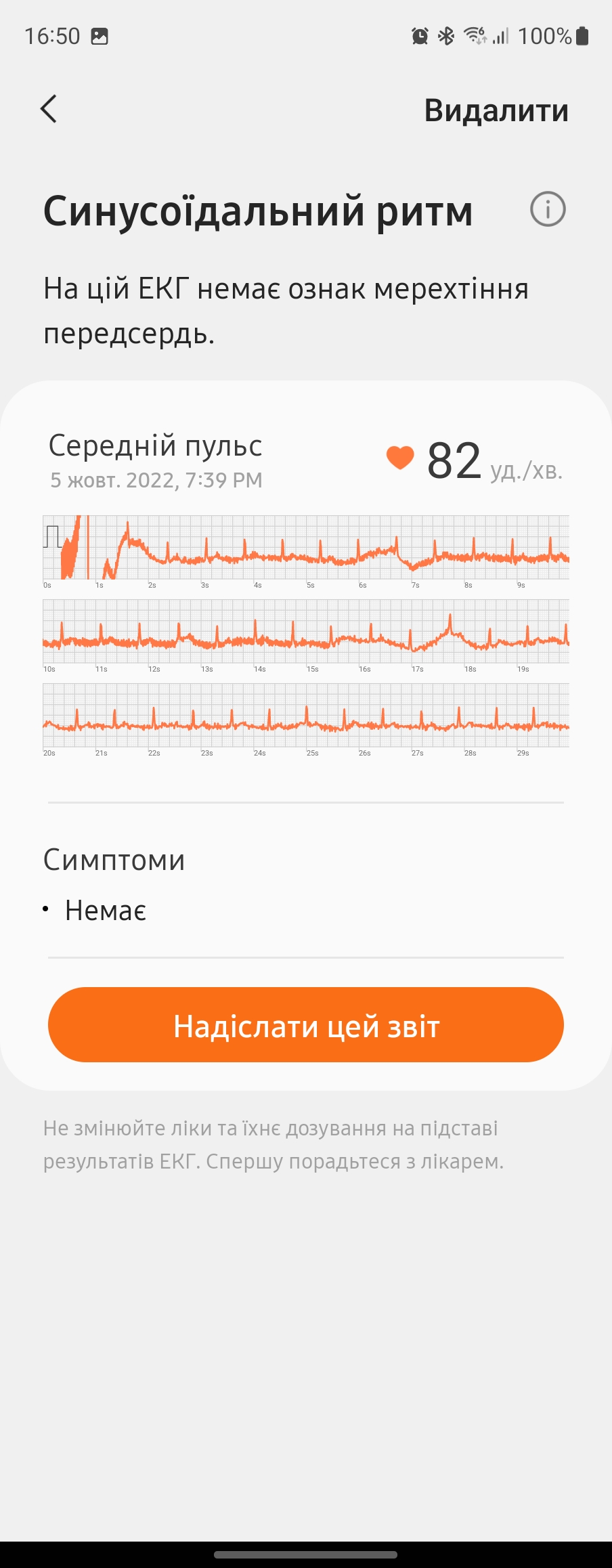 Examen de la Samsung Galaxy Watch5 Pro et de la Watch5 : plus d'autonomie, moins de lunette physique-229