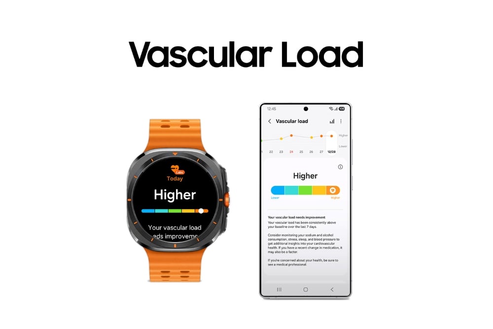 Иллюстративное изображение Vascular Load